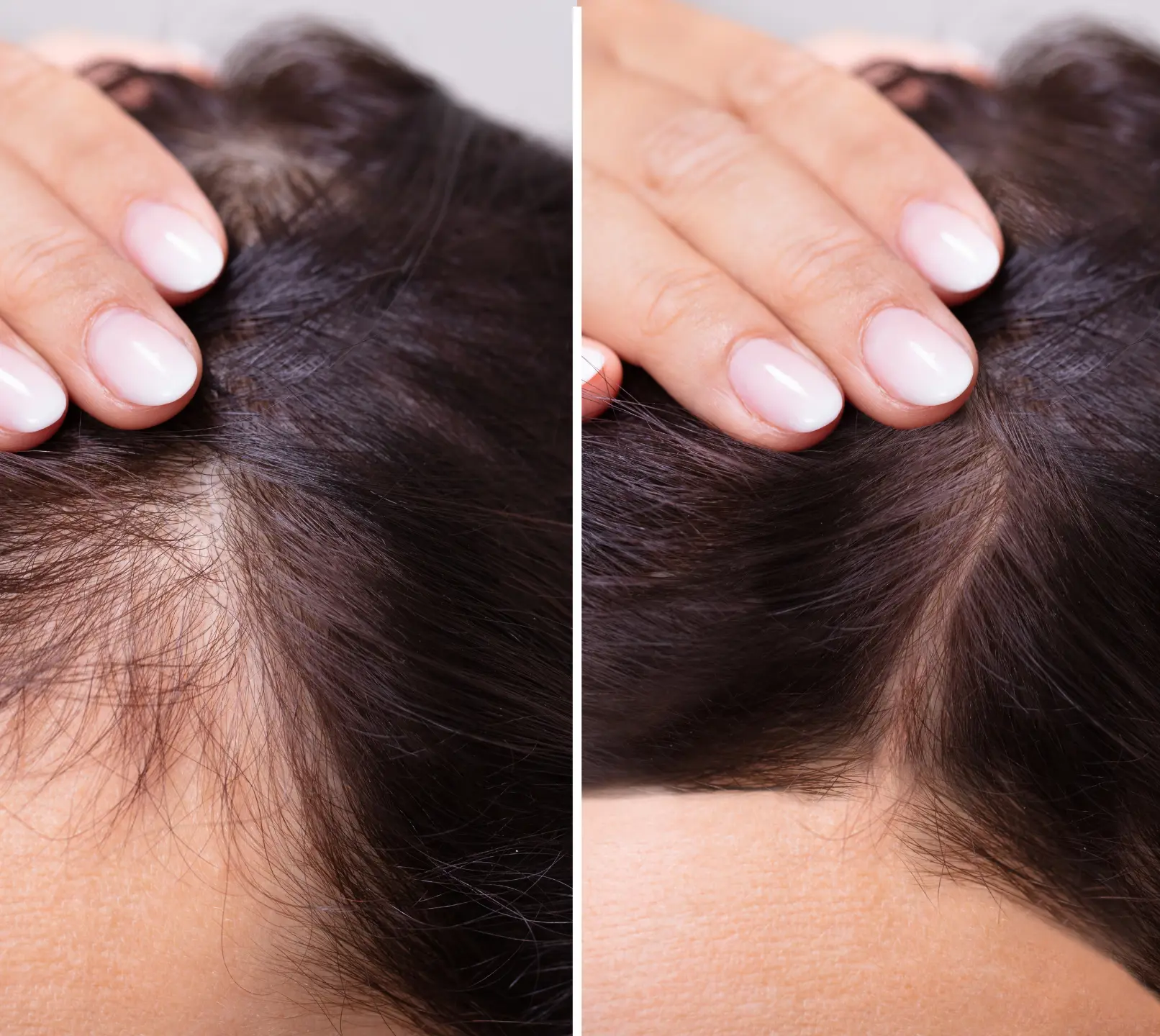 Myhealth Newington Hair Restoration